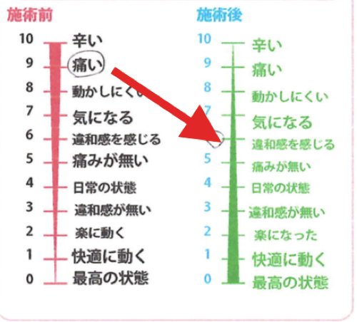 坐骨神経痛でヘルニアの疑い_腰の痛みで前かがみが出来ない症状の原因と治療方法