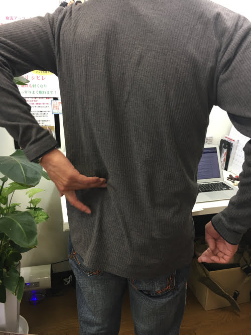 坐骨神経痛でヘルニアの疑い_腰の痛みで前かがみが出来ない症状の原因と治療方法