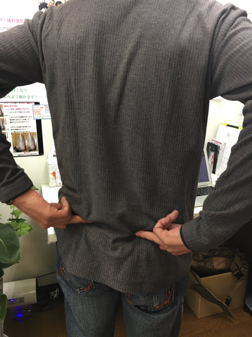 坐骨神経痛でヘルニアの疑い_腰の痛みで前かがみが出来ない症状の原因と治療方法