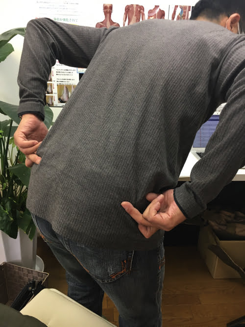 坐骨神経痛でヘルニアの疑い_腰の痛みで前かがみが出来ない症状の原因と治療方法