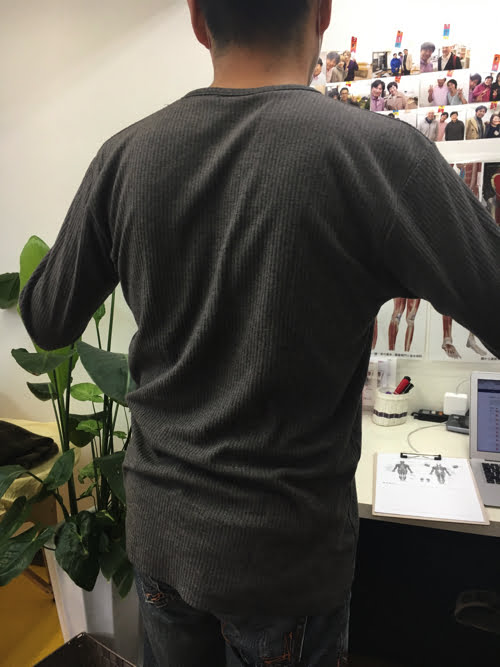 坐骨神経痛でヘルニアの疑い_腰の痛みで前かがみが出来ない症状の原因と治療方法