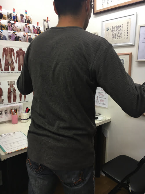 坐骨神経痛でヘルニアの疑い_腰の痛みで前かがみが出来ない症状の原因と治療方法