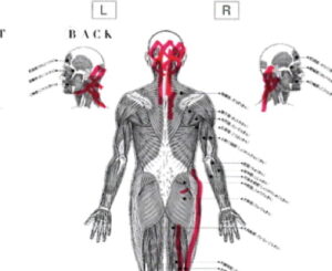 後頭部がデコボコの原因になる硬直した筋肉の図