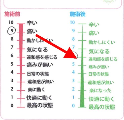 広島-整体院_三叉神経痛や顔面神経痛を手術せずにマッサージで治療
