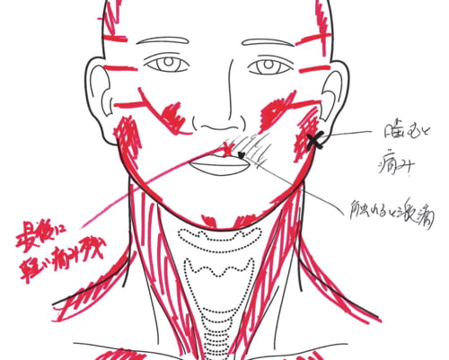 広島-整体院_三叉神経痛や顔面神経痛を手術せずにマッサージで治療