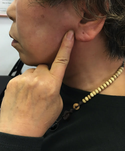 広島-整体院_三叉神経痛や顔面神経痛を手術せずにマッサージで治療