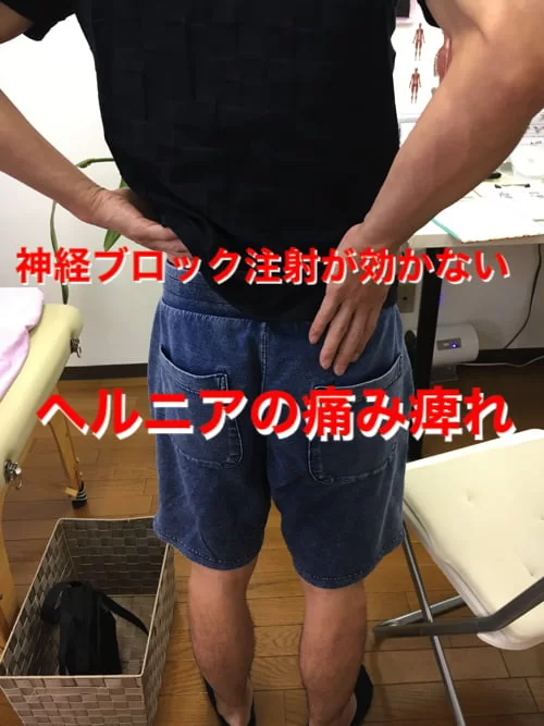 広島_神経ブロック注射が効かないヘルニアの治療