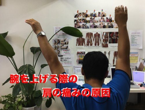 広島_肩の痛みを治す-四十肩治療で有名な整体院