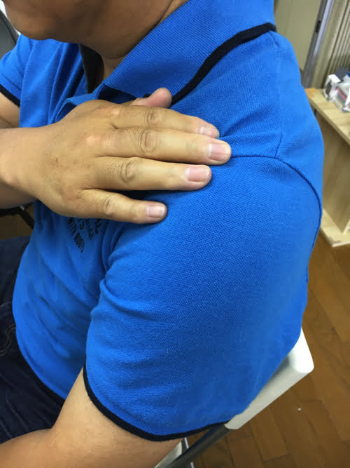 広島_肩の痛みを治す-四十肩治療で有名な整体院