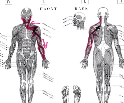 広島_肩の痛みを治す-四十肩治療で有名な整体院