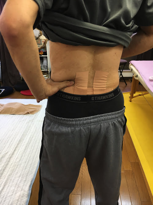 広島_腰痛クチコミ_ぎっくり腰を治す