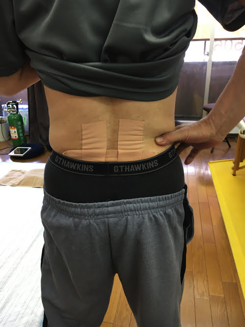 広島_腰痛クチコミ_ぎっくり腰を治す
