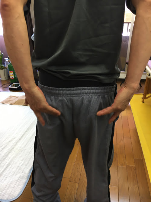 広島_腰痛クチコミ_ぎっくり腰を治す