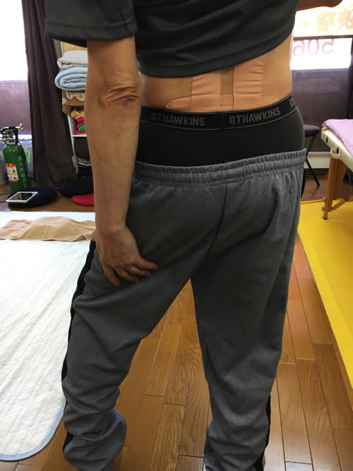 広島_腰痛クチコミ_ぎっくり腰を治す
