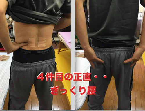 広島_腰痛クチコミ_ぎっくり腰を治す
