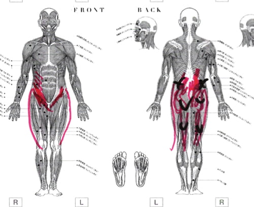 広島_腰痛クチコミ_ぎっくり腰を治す