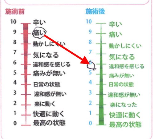広島_腰痛専門の整体師の整形外科では治らないヘルニアの原因と治し方