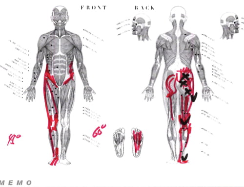 広島_腰痛専門の整体師の整形外科では治らないヘルニアの原因と治し方
