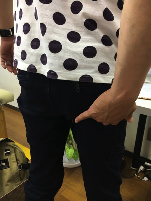 広島_腰痛専門の整体師の整形外科では治らないヘルニアの原因と治し方