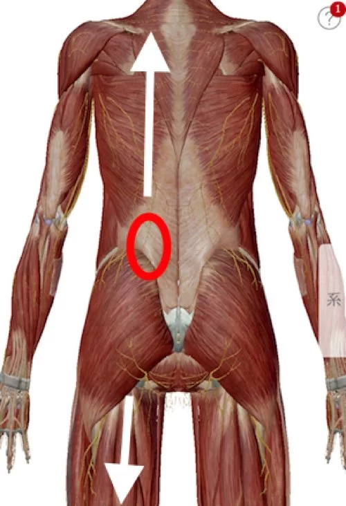広島でヘルニア治療の有名整体院が解説-ヘルニア誤診例