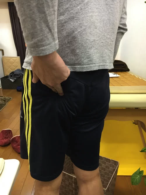 広島でヘルニア治療の有名整体院が解説-ヘルニア誤診例