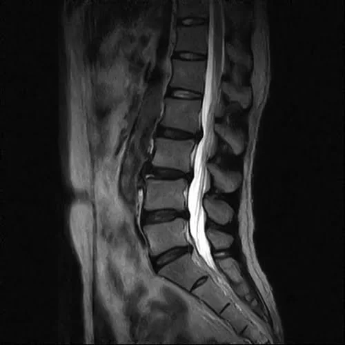 広島でヘルニア治療の有名整体院が解説-ヘルニア誤診例