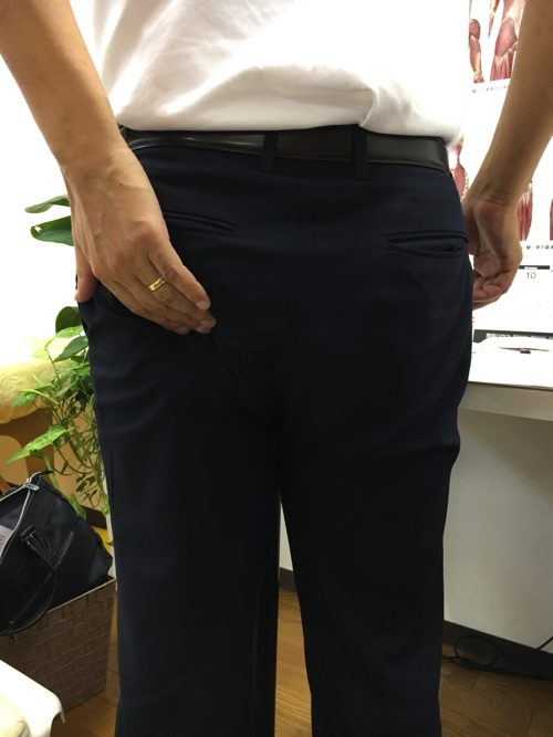 広島で椎間板ヘルニアの治療で有名な整体院の記録-腰の痛みが消えて治った例2