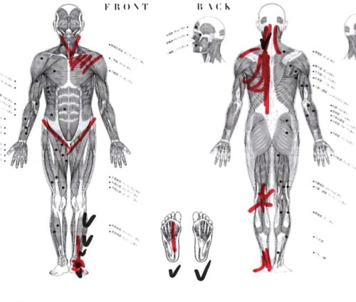 広島で椎間板ヘルニアの治療で有名な整体院の記録-腰の痛みが消えて治った例7