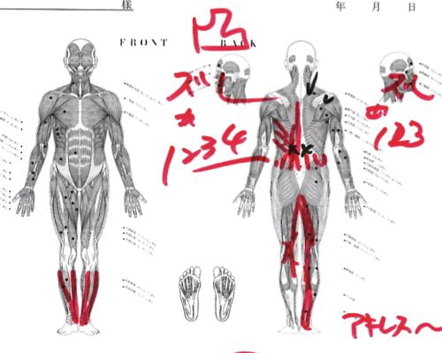 急な腰の痛みの原因と治療方法_ぎっくり腰をすぐに治す