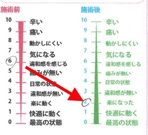 急な腰の痛みの原因と治療方法_ぎっくり腰をすぐに治す