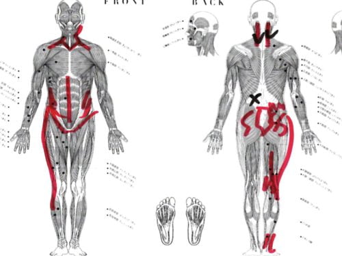 急な腰の痛みの原因と治療方法_ぎっくり腰をすぐに治す