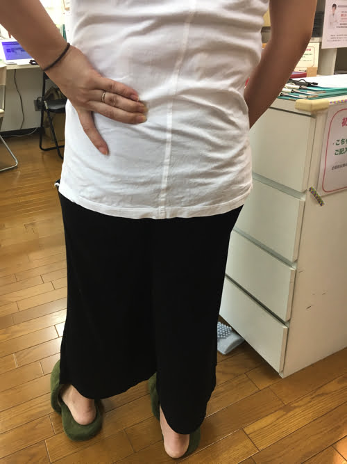 整形外科ではヘルニアと診断された産後腰痛_ブロック注射が効かない腰の痛み