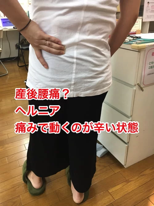 整形外科ではヘルニアと診断された産後腰痛_ブロック注射が効かない腰の痛み