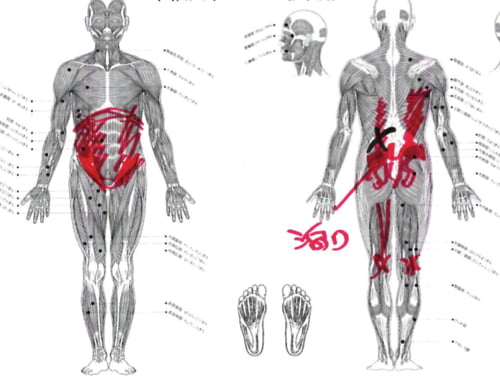 整形外科ではヘルニアと診断された産後腰痛_ブロック注射が効かない腰の痛み