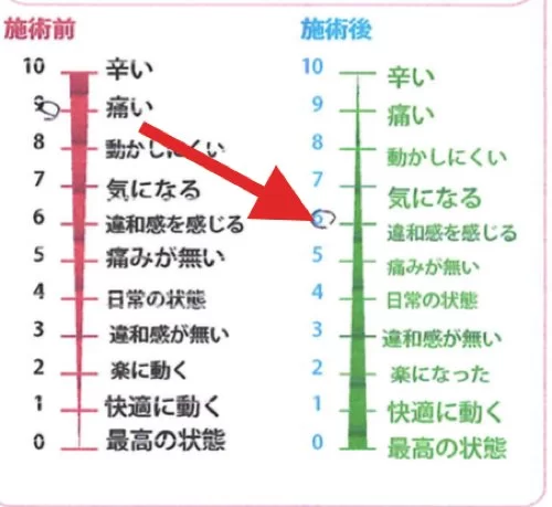 整形外科ではヘルニアと診断された産後腰痛_ブロック注射が効かない腰の痛み