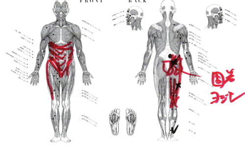 整形外科では治らない椎間板ヘルニアの原因と治療方法_テレビでも紹介されて広島の有名整体師の施術記録
