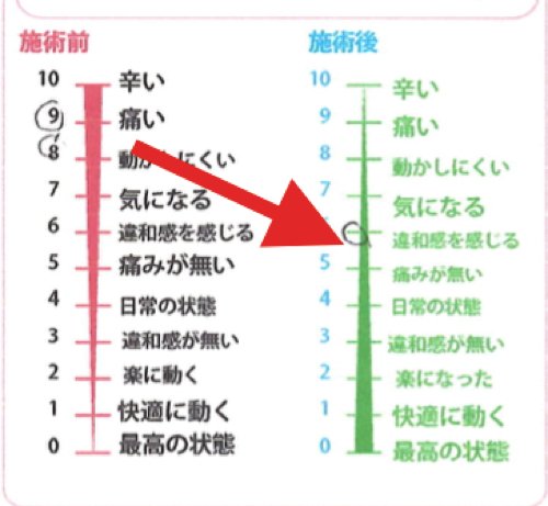整形外科では治らない椎間板ヘルニアの原因と治療方法_テレビでも紹介されて広島の有名整体師の施術記録