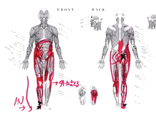 整形外科で治らない脊柱管狭窄症の原因と治療方法-広島の整体院の治った例