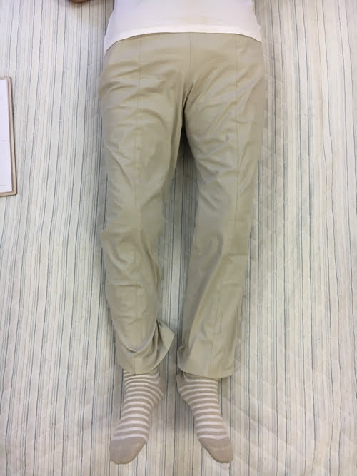 整形外科で治らない脊柱管狭窄症の原因と治療方法-広島の整体院の治った例