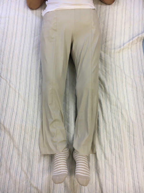 整形外科で治らない脊柱管狭窄症の原因と治療方法-広島の整体院の治った例