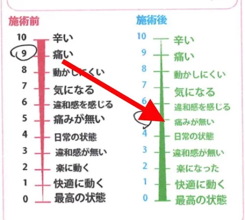 整形外科で治らない脊柱管狭窄症の原因と治療方法-広島の整体院の治った例
