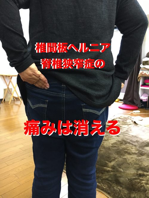 椎間板ヘルニアと脊椎狭窄症の原因と治療方法-広島で椎間板ヘルニア治療で有名な整体院の記録2