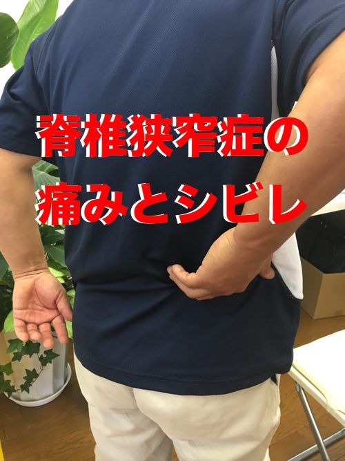 神奈川でヘルニア治療受付-腱引き