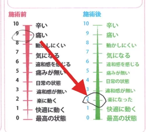 首のコリ_目の奥が痛い_原因と治し方_治療方法_広島の整体院の実例
