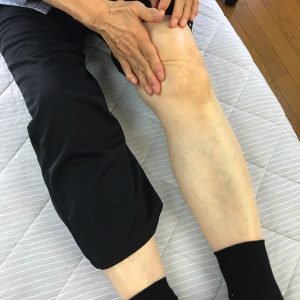 膝の内側の痛みの場所
